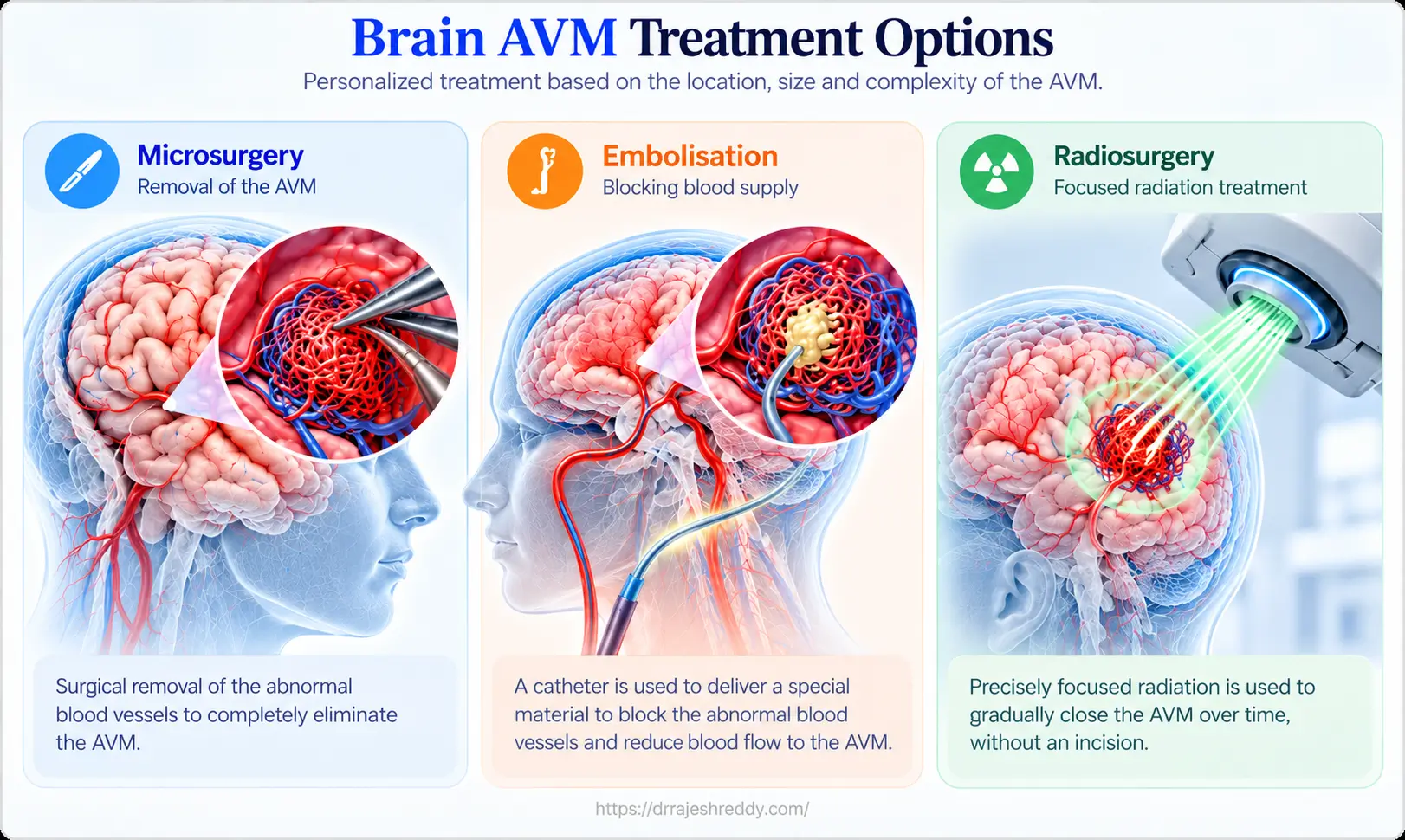AVM Treatment Options