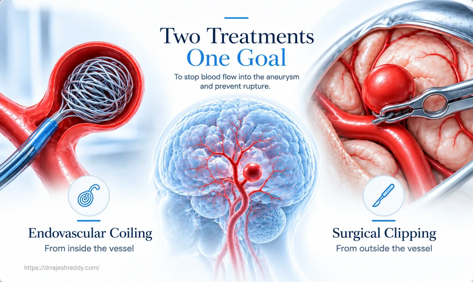 Consult Dr. Rajesh Reddy for Brain Aneurysm Evaluation