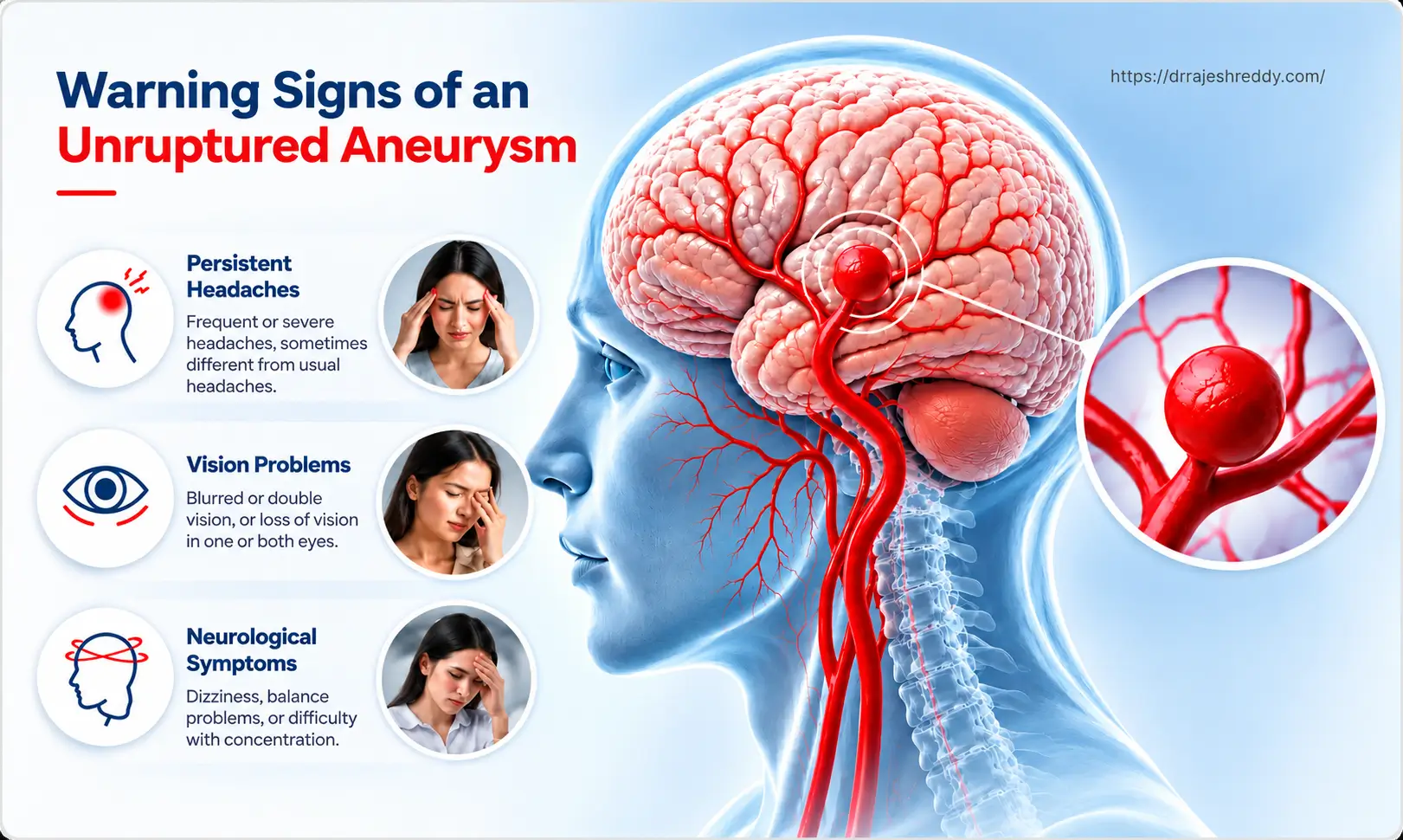 Unruptured Brain Aneurysm Overview