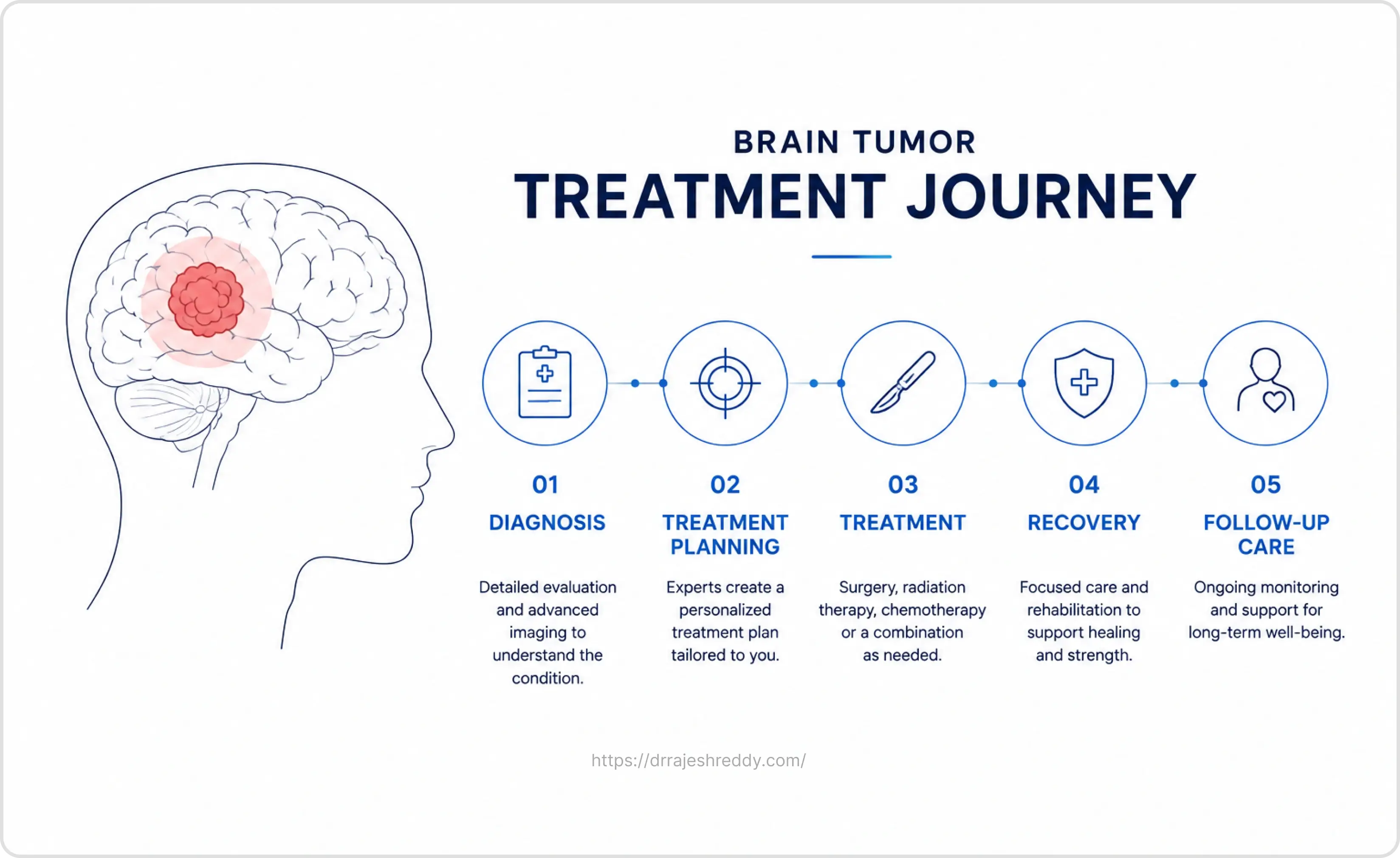 Brain Tumor Treatment Journey from Diagnosis to Recovery