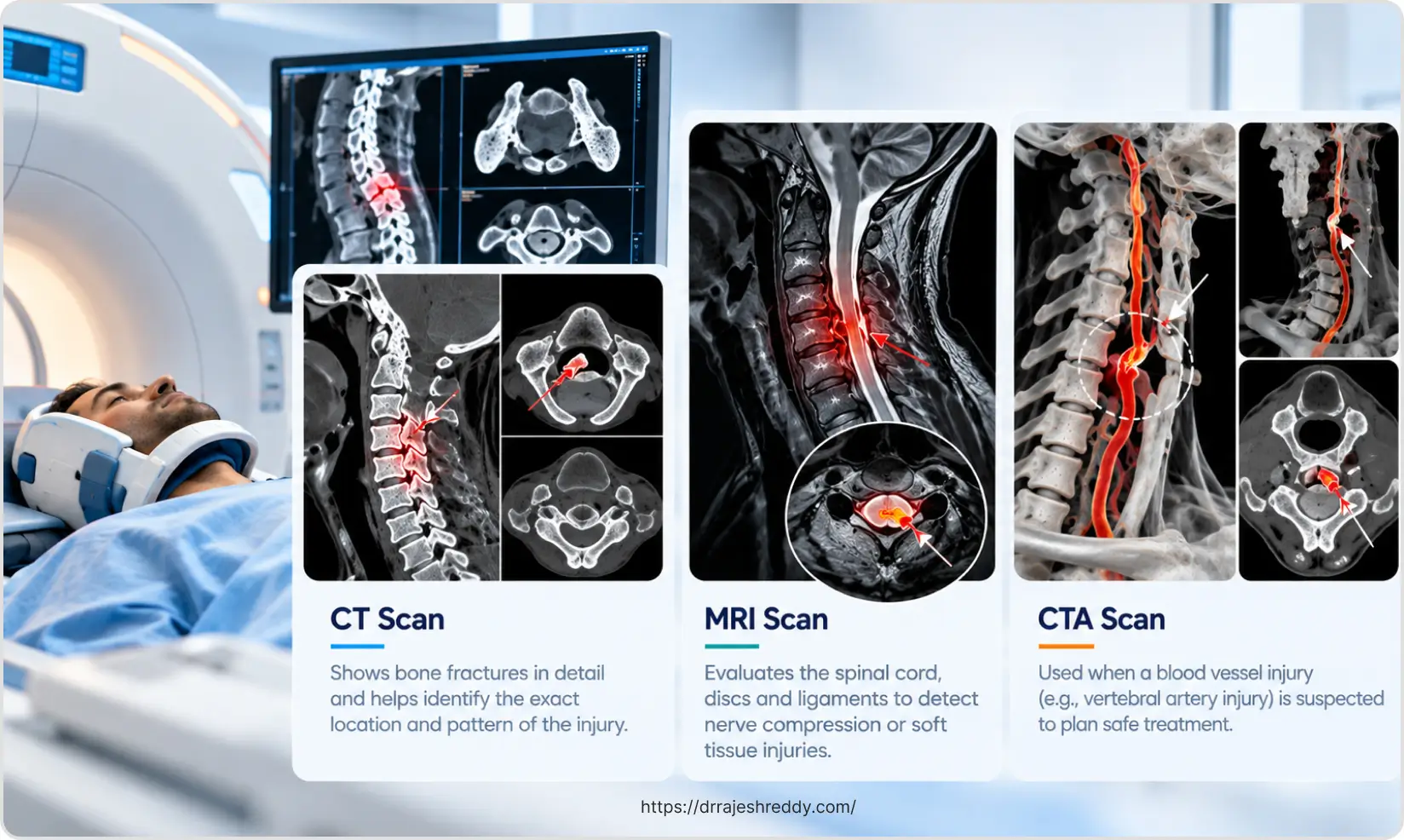 CT, MRI, and CT angiography used to assess cervical spine fractures and associated injuries