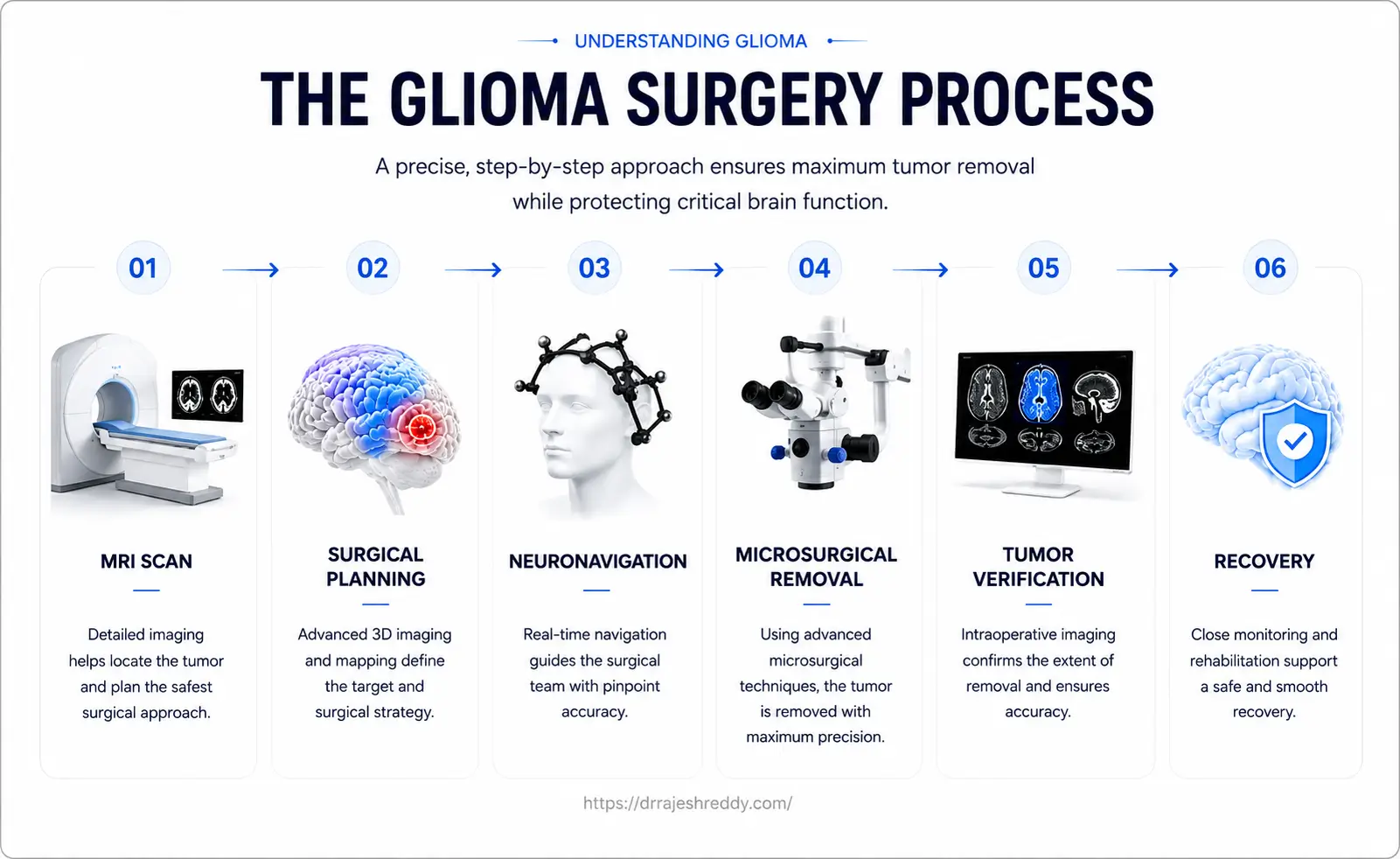 Glioma Surgery Process and Workflow