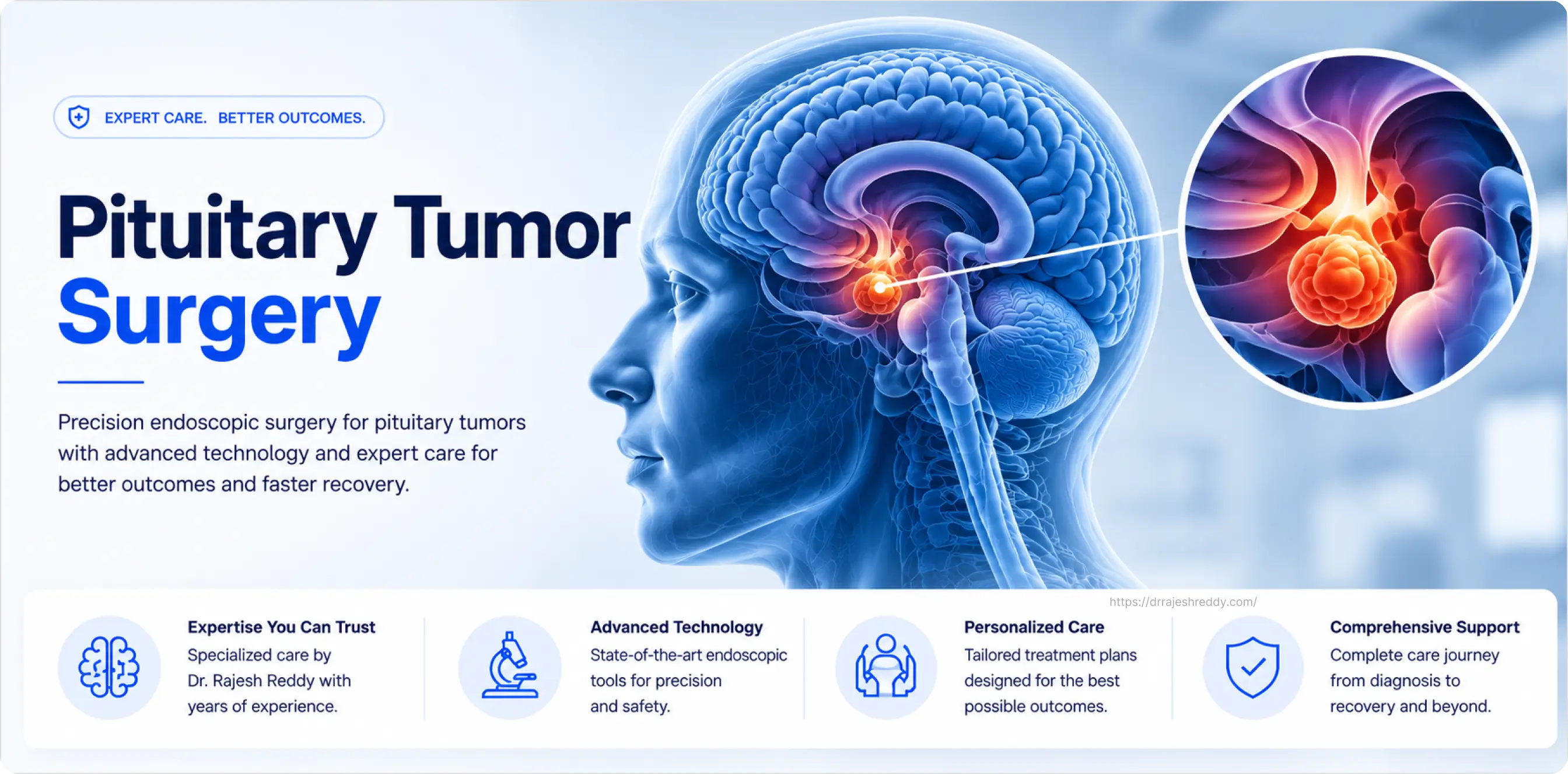 Pituitary Tumor Surgery Guide