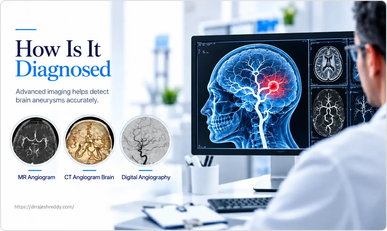 Accurate Diagnosis for Unruptured Brain Aneurysms